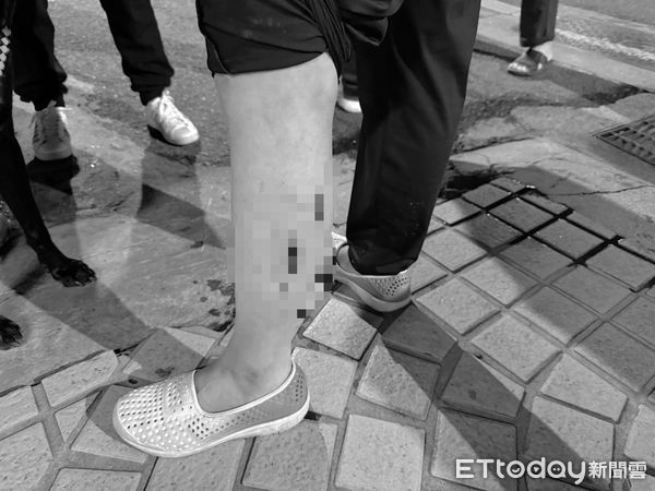 ▲▼黃男的米克斯犬（箭頭）衝向包女的黑狗（紅圈），對黑狗展開攻擊撕咬，造成黑狗右胸開放傷口輕微氣胸，包女左小腿被咬傷留下3個流血齒洞             。（圖／記者陳以昇翻攝）