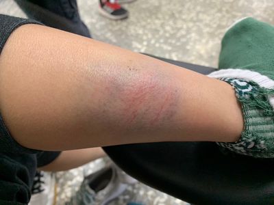 桃園某補習班狼師襲胸、把學生打到全身瘀青 負責人拿球棒「巡堂」