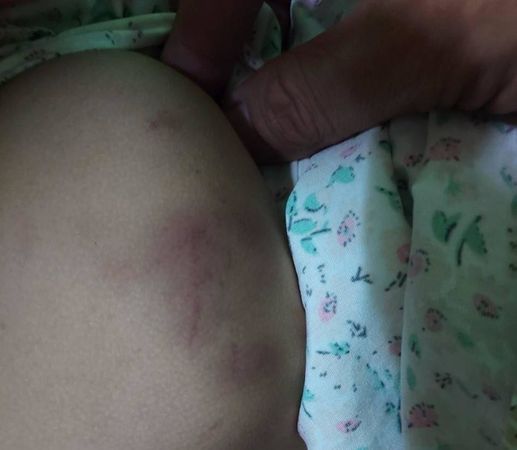 ▲▼台東縣關山國小學前特幼班老師施暴特教幼兒園學生。（圖／伍麗華國會辦公室提供）