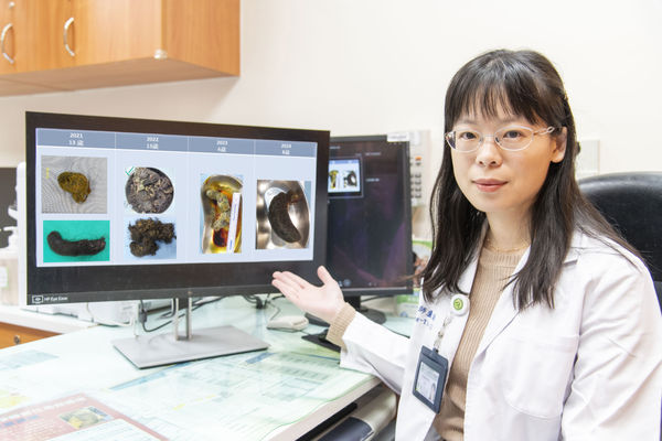 ▲彰化8歲女童罹患長髮公主症。（圖／彰基提供）