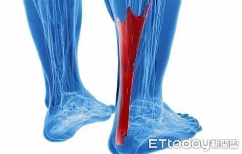 ▲阿基里斯腱是人體中最粗、最強的肌腱，是幫助日常中走路、上下樓，也是跑步、跳躍的重要結構。（圖／花蓮醫院提供，下同）