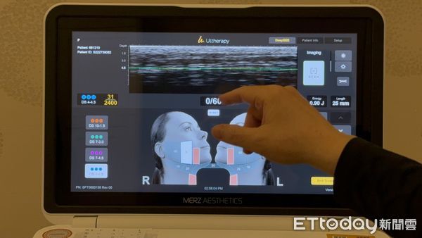 ▲超音波影像應用在臉部微整技術            。（圖／記者吳奕靖攝）