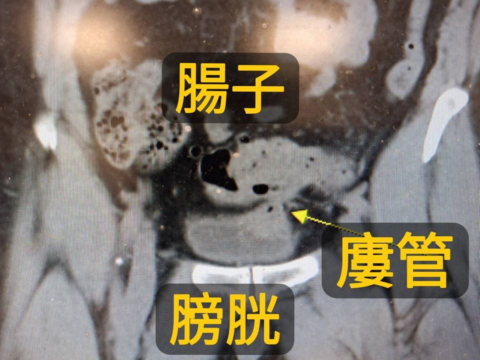 （圖／翻攝戴定恩臉書）
