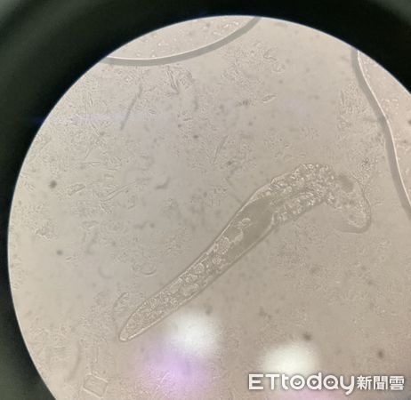 ▲沈冠宇醫師,蠕型螨蟲。（圖／記者游瓊華攝）