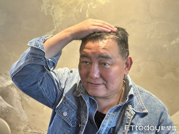 ▲▼徐亨露出頭上的導管。（圖／記者蔡琛儀攝）