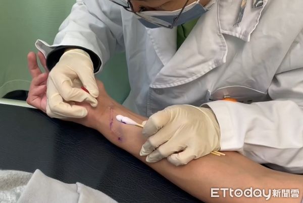 ▲李先生傷後右手指無力，透過放鬆筋膜，感覺及動作功能逐漸改善。（圖／記者許宥孺翻攝）