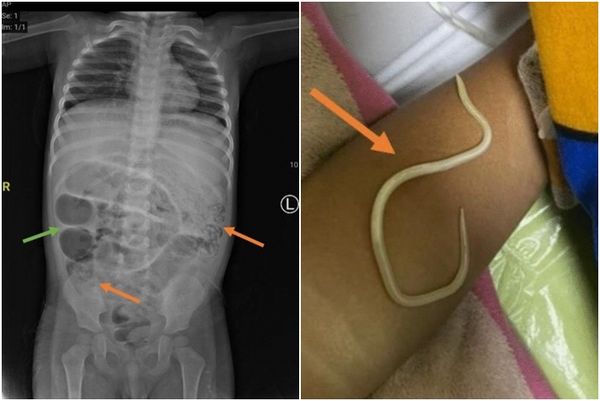 ▲▼             。（圖／翻攝自Journal of Medical Case Reports）