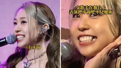 3秒魔術「把牙齒變不見」!全場拉近拍 艾薇:只有我一個歌手做到