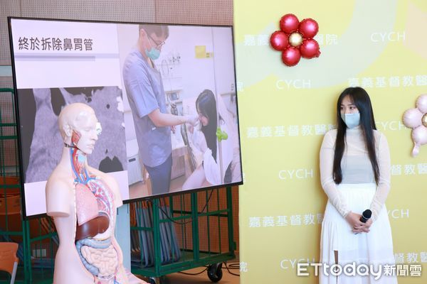 ▲▼   亞洲首例！嘉基創新內視鏡縫線技術 成功修補頑固食道穿孔 助正妹重拾美味人生   。（圖／嘉義基督教醫院提供）