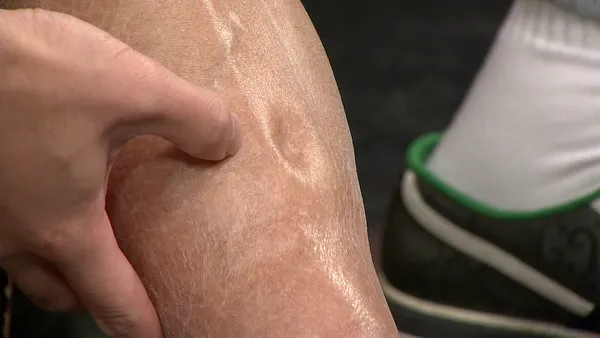 ▲孔鏘坦言右腳不明腫脹2個月，非常擔心若被截肢就無法再彈琴了。（圖／年代提供）