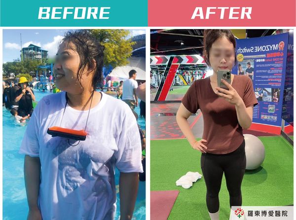 ▲▼醫學減重中心邱旭緯主任分享，生活中的不適感如果忽略，長期累積會導致更嚴重的慢性病，肥胖者應趁著症狀輕微之際減重，早一步避免不可逆的慢性疾病發生。（圖／羅東博愛醫院提供）