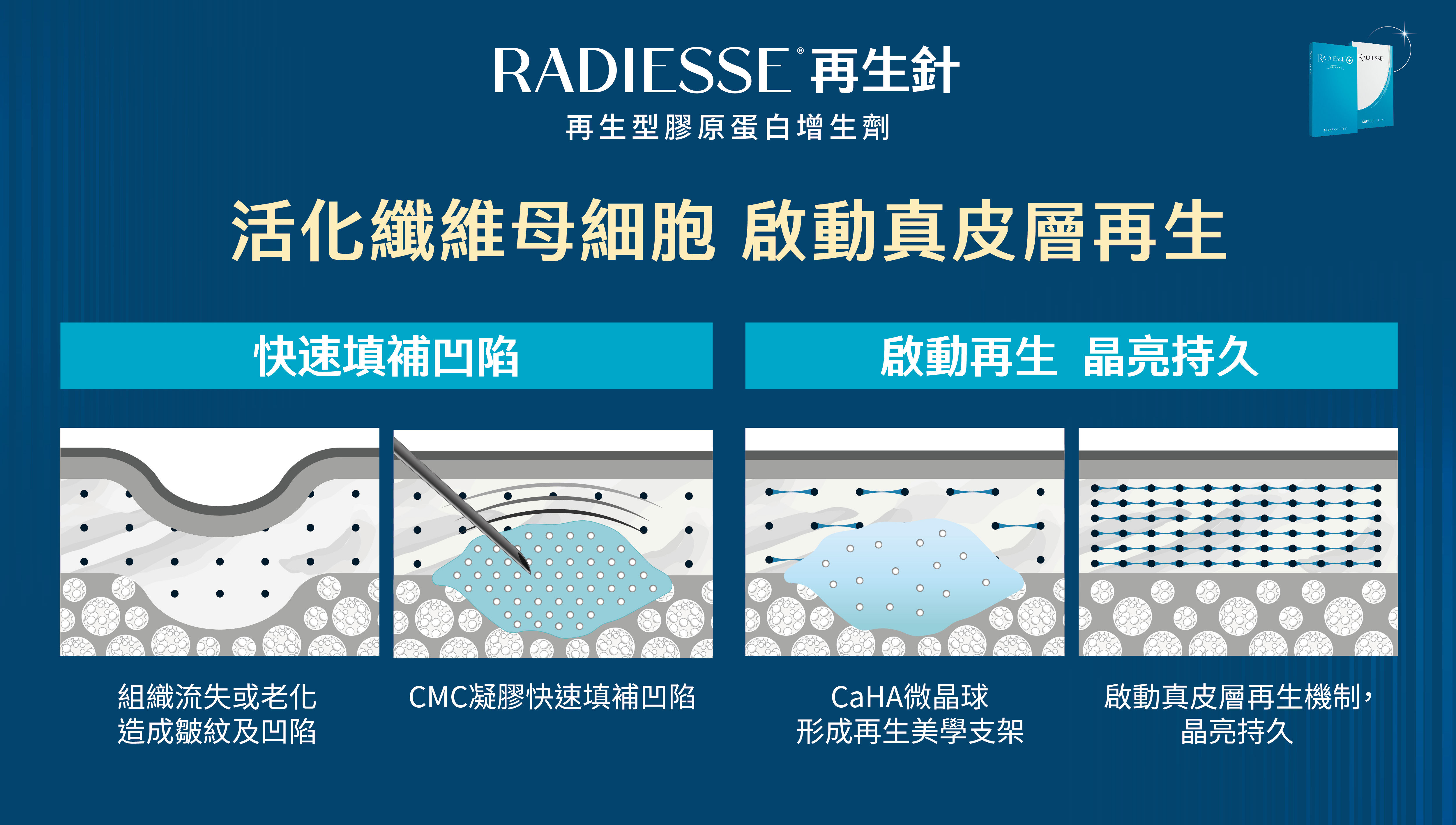 ▲▼醫美,母親節,變美,保養,再生針,膠原蛋白,增生劑,支撐,注射,填充,Radiesse,高級臉,再生美學,彤顏診所。（圖／彤顏診所提供）