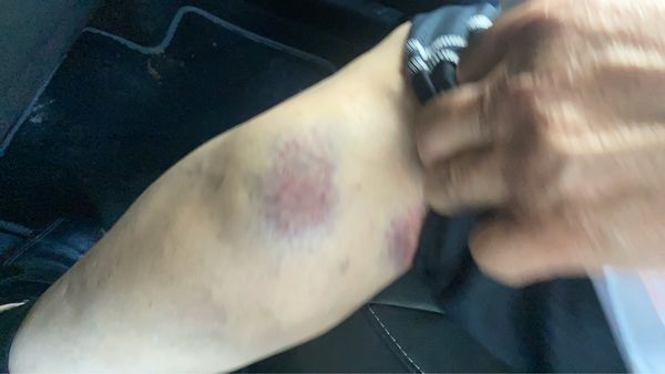 ▲彰化芳苑農會理事長遭毆打。（圖／民眾提供）