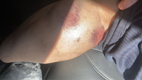 ▲彰化芳苑農會理事長遭毆打。（圖／民眾提供）