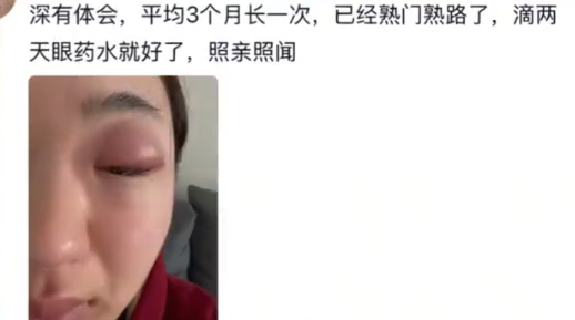 ▲▼陸女星聞嬰兒腳致眼睛感染。（圖／翻攝自微博）