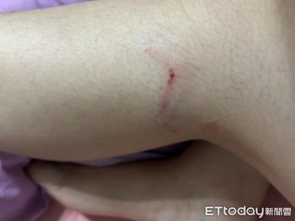 ▲新竹南寮踏浪遇浪犬攻擊。（圖／網友湯佩凌提供，請勿隨意翻拍，以免侵權。）