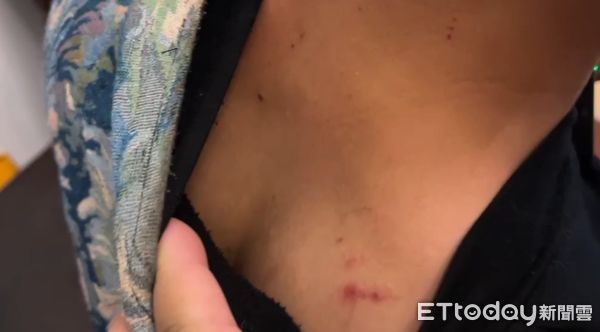 ▲民宿洪姓老闆控訴遭羅男6人圍毆頭部重擊，市警二分局警方已將羅男等人依法送辦。（記者林東良翻攝，下同）