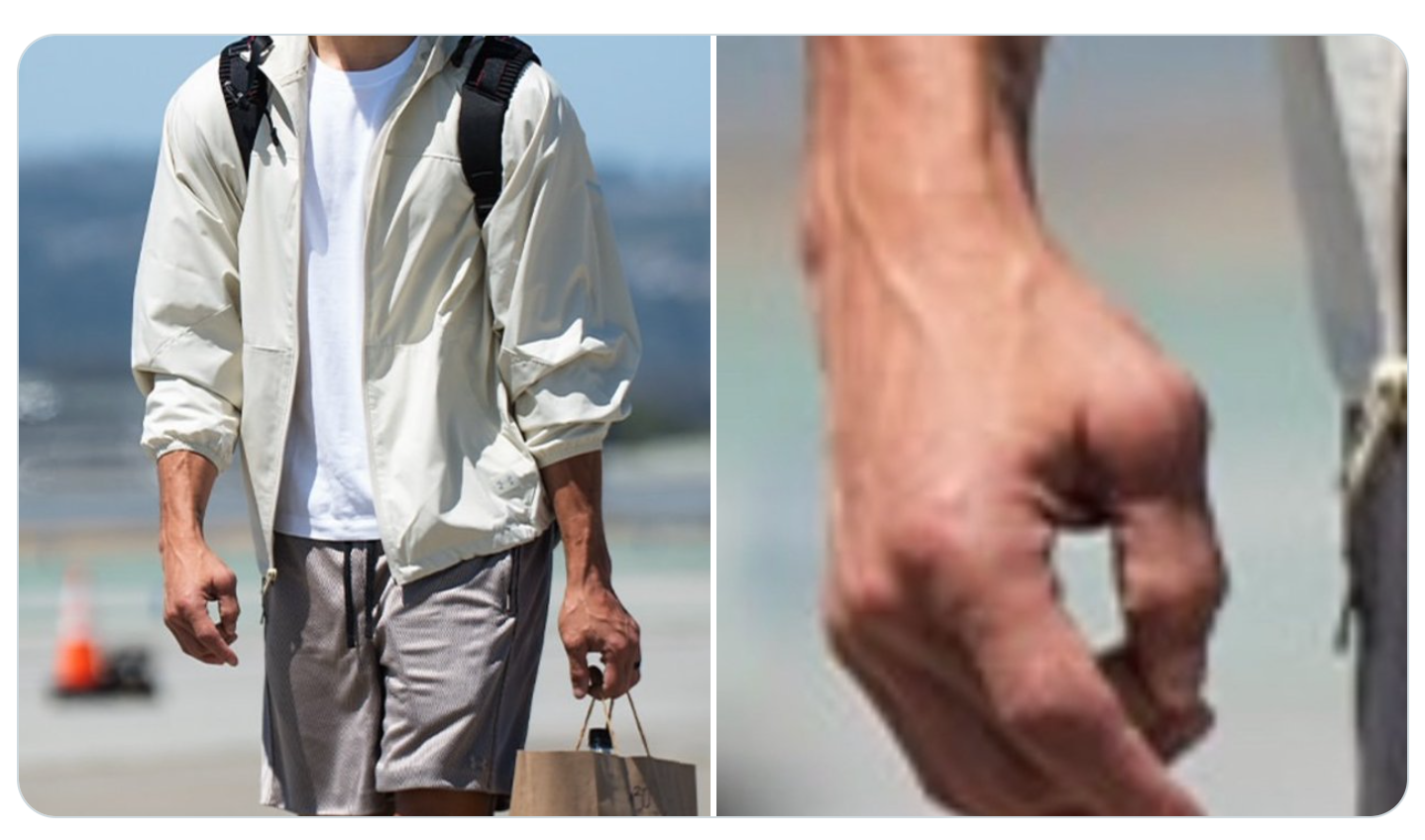 ▲▼勇士一哥柯瑞的右手拇指極度腫脹，引起關注     。（圖／翻攝自X／warriorsworld）