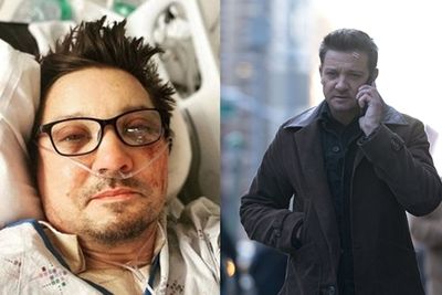 「遭重輾左眼爆出」鷹眼認了片酬砍半！　親曝未接演《鷹眼2》原因