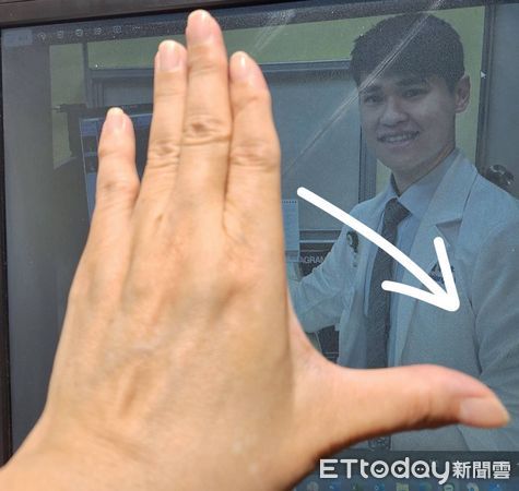 ▲▼醫師建議平日可以做拇指舒展保健運動鍛鍊肌力 。（圖／記者許宥孺翻攝）