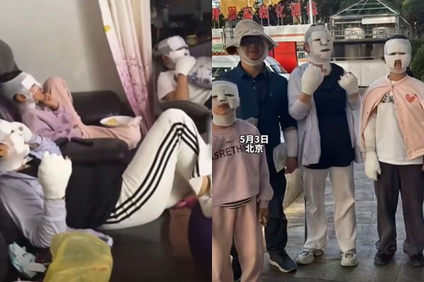 ▲▼北京陳姓男子與鄰居相約燒烤，卡式爐突然爆炸，導致幾人包成木乃伊。（圖／翻攝抖音）