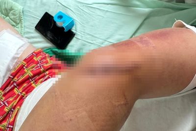 台南仁德服務區驚傳砍人！男抽菸遭追砍肌腱斷裂　疑鎖定目標尋仇