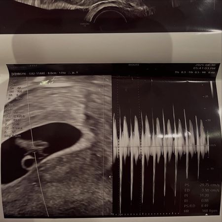 ▲▼徐敏在。（圖／翻攝自Instagram／seominjae_71）