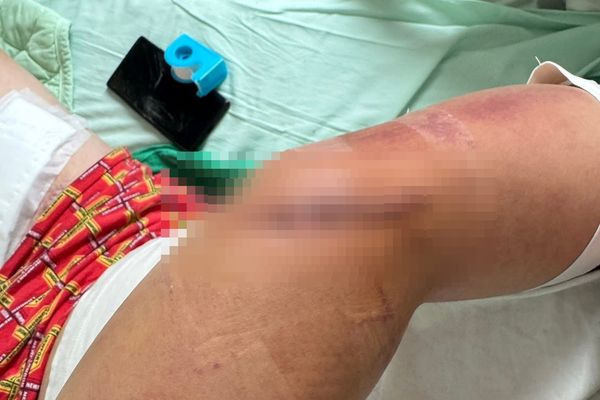 ▲國道仁德服務區一名男子抽菸時突遭狠砍四肢。（圖／翻攝自Facebook／爆料公社，下同）