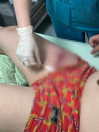 ▲國道仁德服務區一名男子抽菸時突遭狠砍四肢。（圖／翻攝自Facebook／爆料公社，下同）