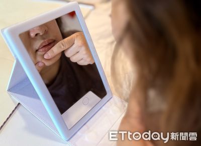 青春痘纏身不敢笑!15歲女學生靠中醫清熱解毒 臉蛋恢復光滑自信回來了