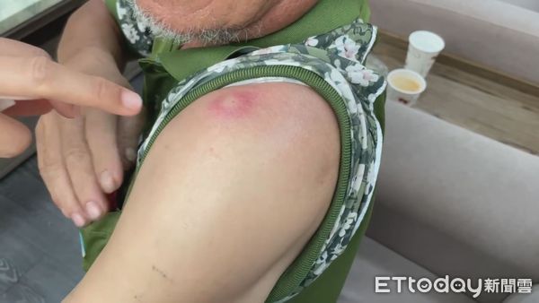 ▲▼ 雲林縣斗南鎮5月3日一名清潔隊員遭民眾攻擊            。（圖／記者游瓊華翻攝）