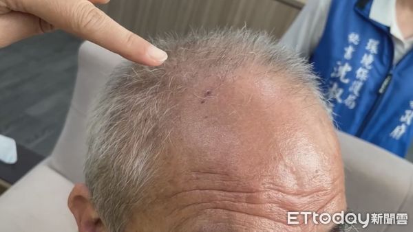 ▲▼ 雲林縣斗南鎮5月3日一名清潔隊員遭民眾攻擊            。（圖／記者游瓊華翻攝）