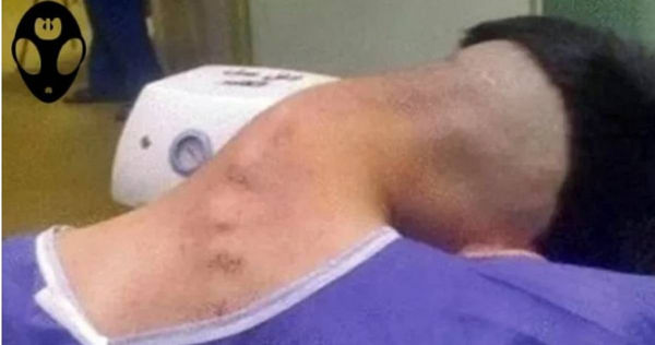 男子長期使用安非他命，患垂頭症候群。（圖／翻攝Spooky X）