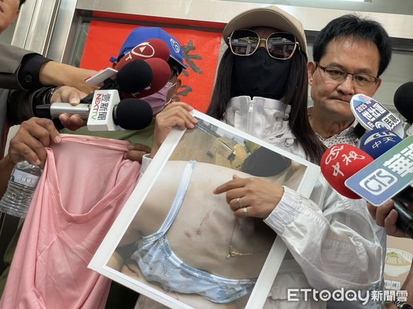 ▲▼妙齡女子被飯店吹風機噴火燒傷，不滿2年都被漠視，墾丁福容發出聲明，但遭簡女打臉，願意公開對質。（圖／記者鄧木卿攝，下同）