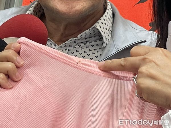 ▲▼妙齡女子被飯店吹風機噴火燒傷，不滿2年都被漠視，墾丁福容發出聲明，但遭簡女打臉，願意公開對質。（圖／記者鄧木卿攝，下同）