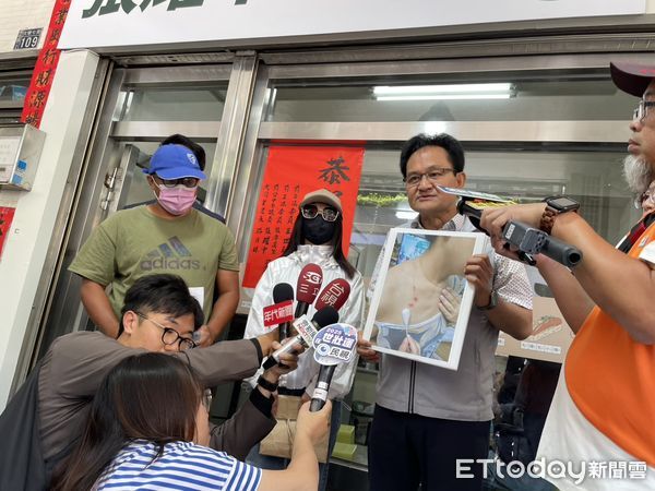 ▲▼妙齡女子被飯店吹風機噴火燒傷，不滿2年都被漠視，墾丁福容發出聲明，但遭簡女打臉，願意公開對質。（圖／記者鄧木卿攝，下同）