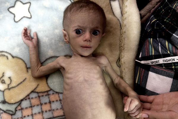 ▲▼ 加薩女嬰希瓦（Siwar Ashour）。（圖／VCG）