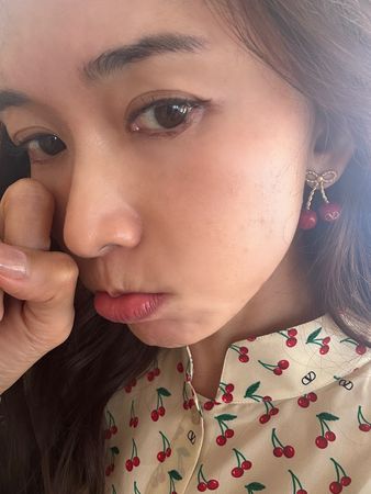 ▲▼林志玲飛坎城出席電影論壇，臉蛋大過敏。（圖／翻攝自臉書、微博）