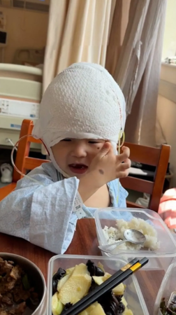 ▲▼3歲童罹罕病！頭長巨痣被嘲「米奇」　手術成功終於笑了。（圖／翻攝自微博）