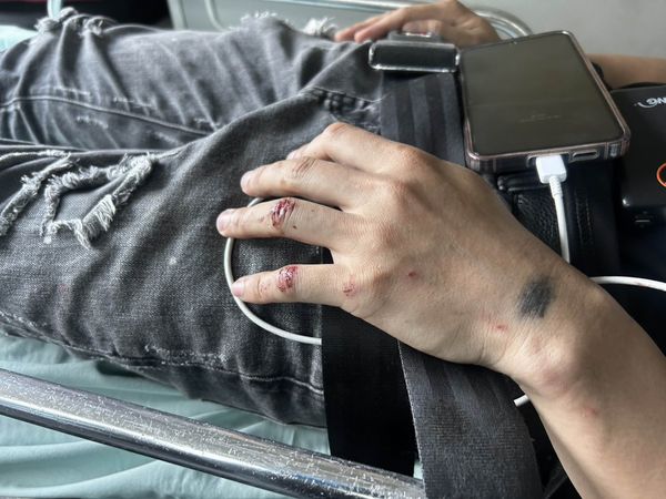 ▲彰化芬園鄉139縣道移工過彎摔車等3小時，警方及時救援。（圖／記者唐詠絮翻攝）