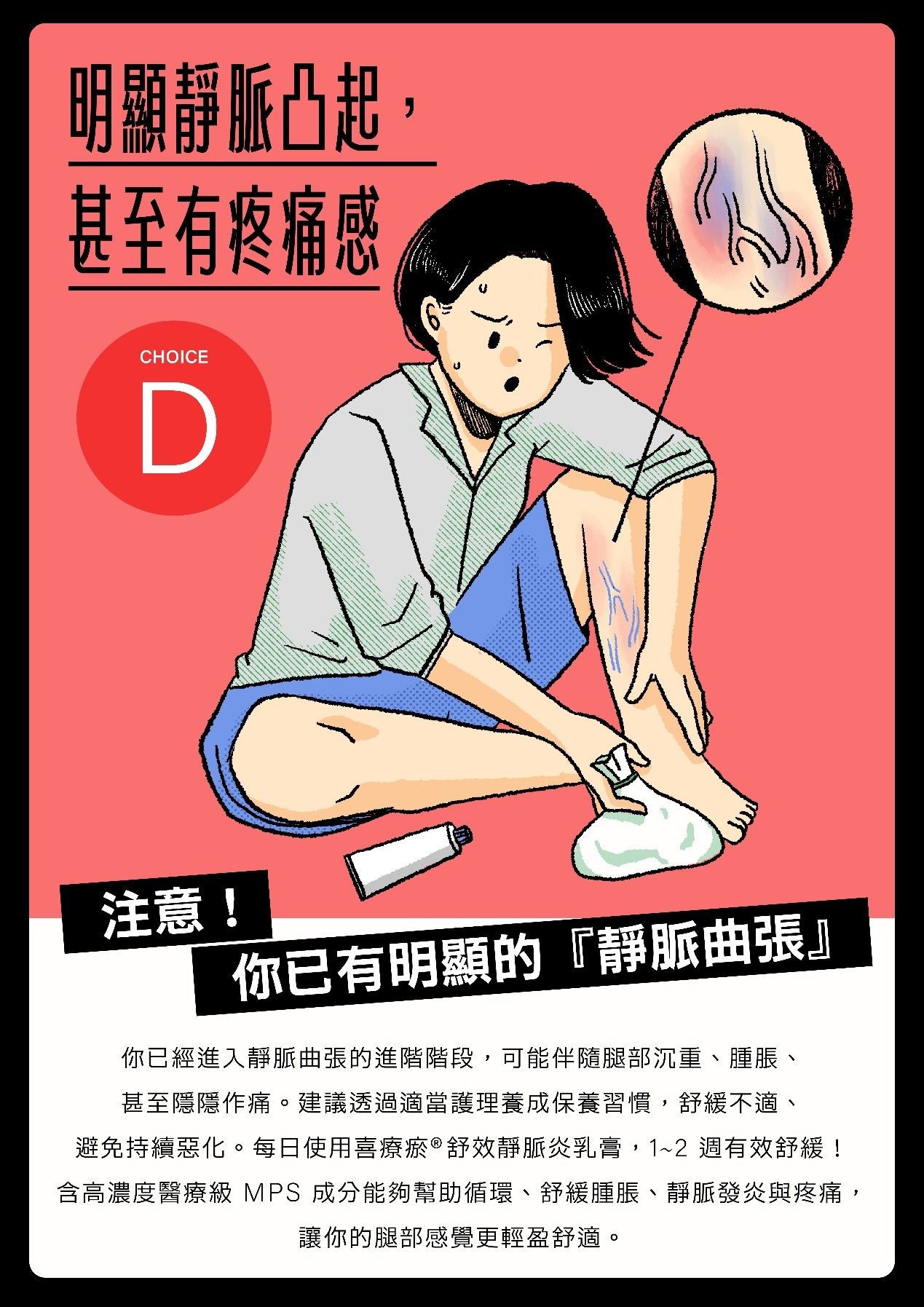 靜脈炎,靜脈曲張,久坐久站,服務業,上班族,腿腫,小腿,雙腿,浮腳筋,外用乳膏,喜療瘀舒效靜脈炎乳膏（圖／業者提供）