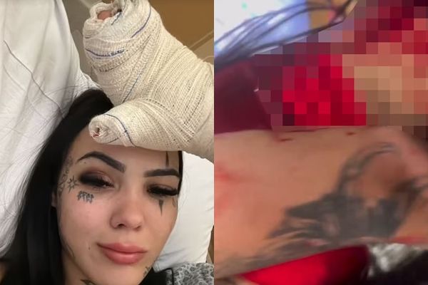 ▲▼22歲正妹網紅直播中「遭男友連砍9刀」！。（圖／翻攝自X）