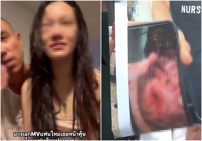 泰女星遭警二代前男友家暴!腫成豬頭還噴血 恐怖囚禁畫面曝光