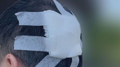 男童高樓玩「丟泥巴」涉殺人未遂! 鄰居遭砸破腦袋