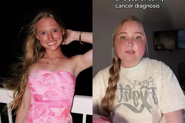 ▲▼19歲正妹網美患腦癌！臉腫成2倍嚴重變形   不到1年病逝。（圖／Instagram／pheelan.anna）