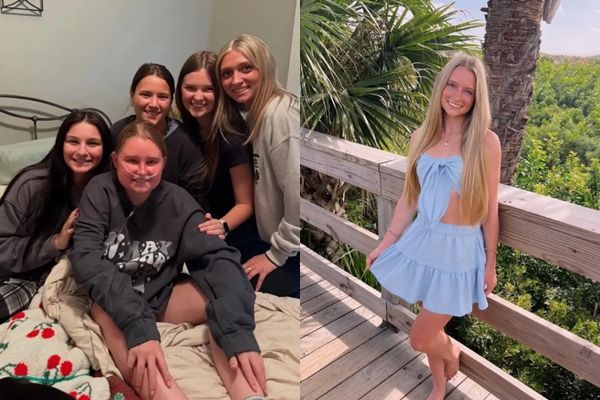 ▲▼19歲正妹網美患腦癌！臉腫成2倍嚴重變形   不到1年病逝。（圖／Instagram／pheelan.anna）