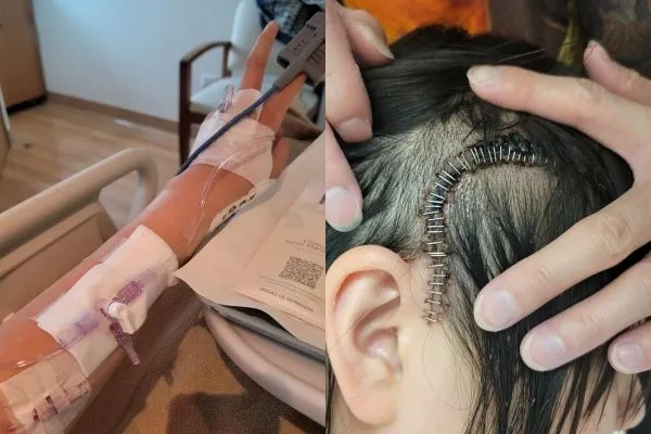 台灣女子小高在智利旅遊期間騎車摔倒，導致顱內出血，緊急送醫開刀治療。（圖／網友小高提供，請勿隨意翻拍，以免侵權。）