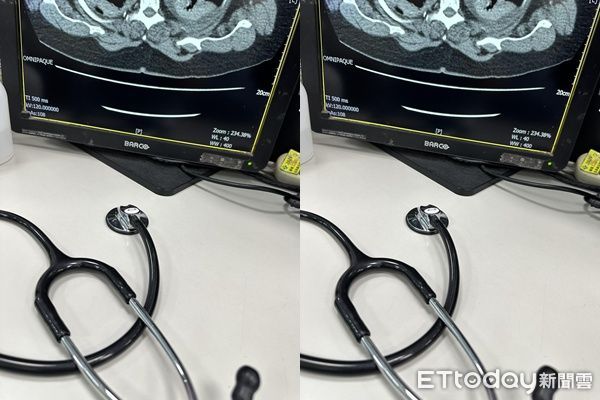 ▲年輕男「酒醉中風」送急診！醫揭超荒謬一幕。（圖／「達特傑生Dr.Jason」授權引用）