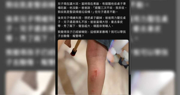 爸爸用皮帶抽打男童，導致小腿處有明顯傷疤。（圖／翻攝自Threads）