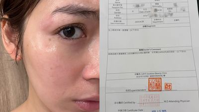 200度捲髮棒砸臉燙傷！　大馬女星控訴台北髮廊「整個月不讀不回」
